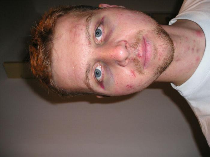 foto k příspěvku  od cupra.165